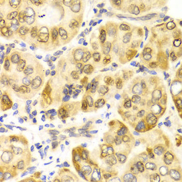 Metabolism Antibodies 2 Anti-CPT2 Antibody CAB2876