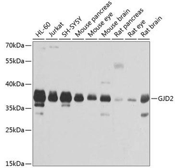 Cell Biology Antibodies 8 Anti-GJD2 Antibody CAB2883