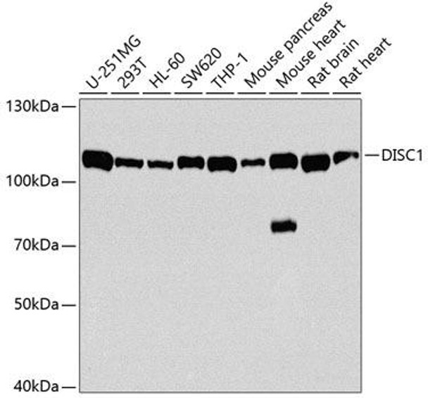 Neuroscience Anti-DISC1 Antibody CAB2898