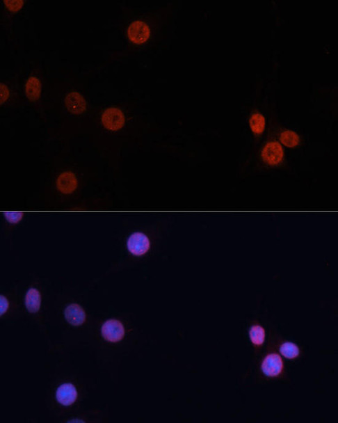 Cell Biology Antibodies 8 Anti-DNMT3B Antibody CAB2899