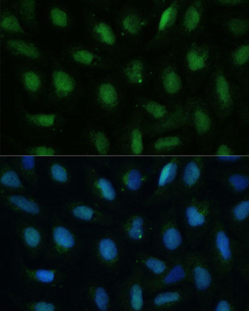 Metabolism Antibodies 2 Anti-DUT Antibody CAB2901