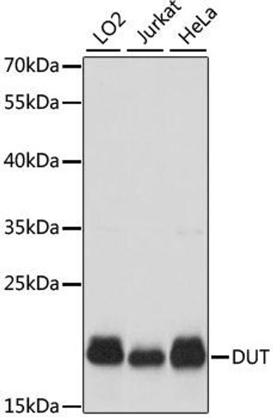 Metabolism Antibodies 2 Anti-DUT Antibody CAB2901