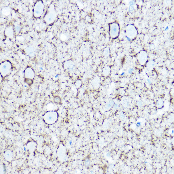 Neuroscience Anti-GAD1 Antibody CAB2938