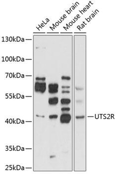 Cell Biology Antibodies 8 Anti-UTS2R Antibody CAB2959