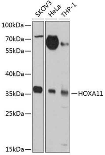 Epigenetics and Nuclear Signaling Antibodies 3 Anti-HOXA11 Antibody CAB2976