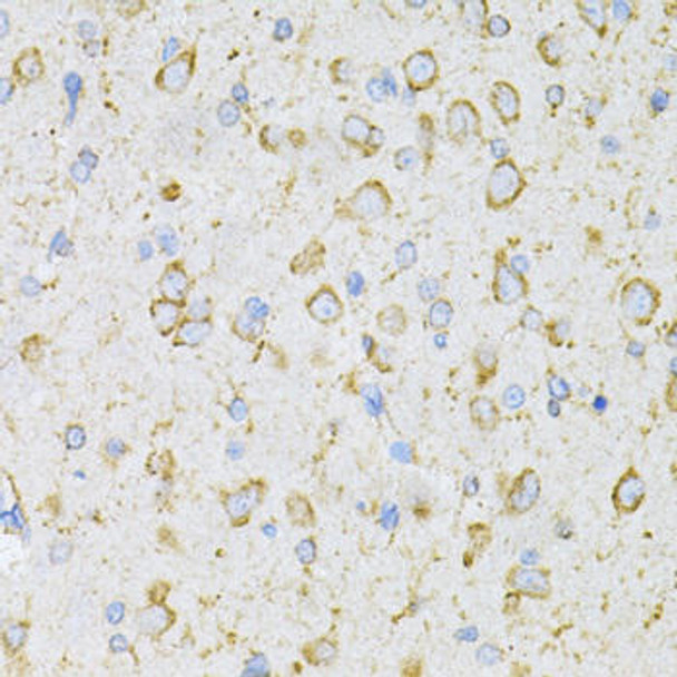 Cell Biology Antibodies 8 Anti-LRPAP1 Antibody CAB3004