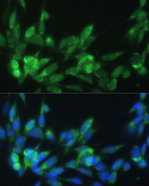 Cell Biology Antibodies 8 Anti-LRPAP1 Antibody CAB3004