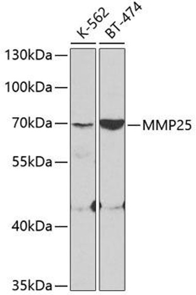 Cell Biology Antibodies 8 Anti-MMP25 Antibody CAB3032