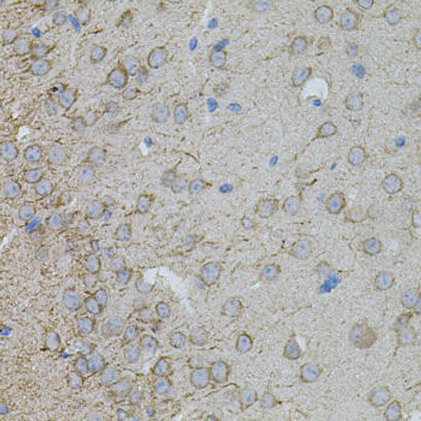Cell Biology Antibodies 8 Anti-MMP10 Antibody CAB3033