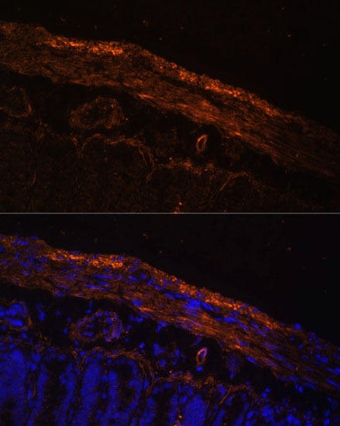 Cell Biology Antibodies 8 Anti-MYL9 Antibody CAB3039