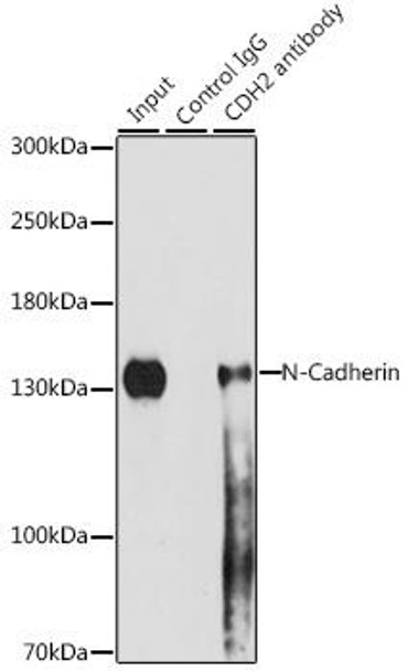 KO Validated Antibodies 1 Anti-N-Cadherin Antibody CAB3045KO Validated