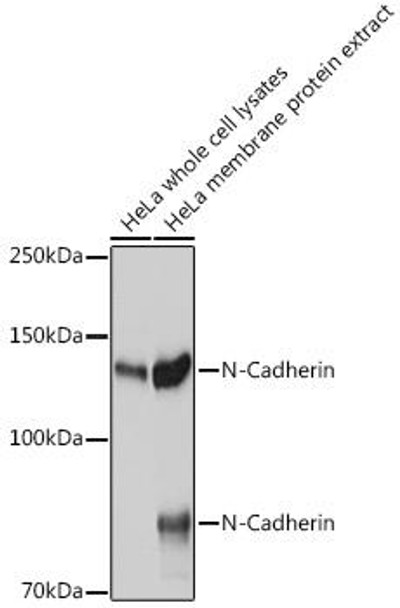 KO Validated Antibodies 1 Anti-N-Cadherin Antibody CAB3045KO Validated