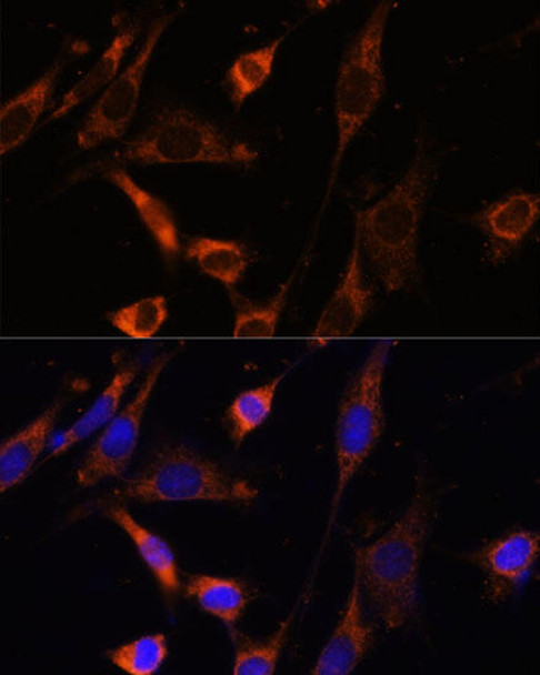 Cell Biology Antibodies 8 Anti-CKMT1B Antibody CAB3046