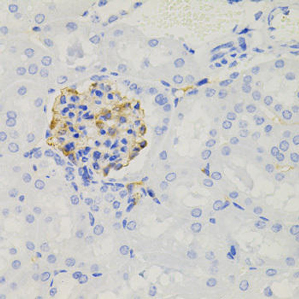 Cell Biology Antibodies 8 Anti-NPHS1 Antibody CAB3048