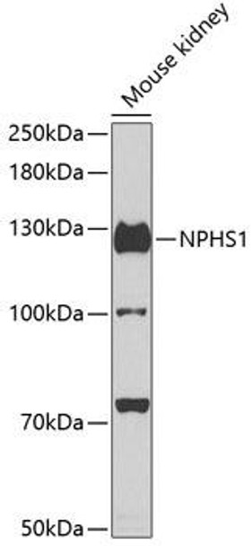 Cell Biology Antibodies 8 Anti-NPHS1 Antibody CAB3048