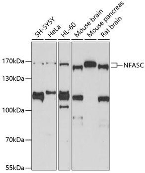 Cell Biology Antibodies 8 Anti-NFASC Antibody CAB3053