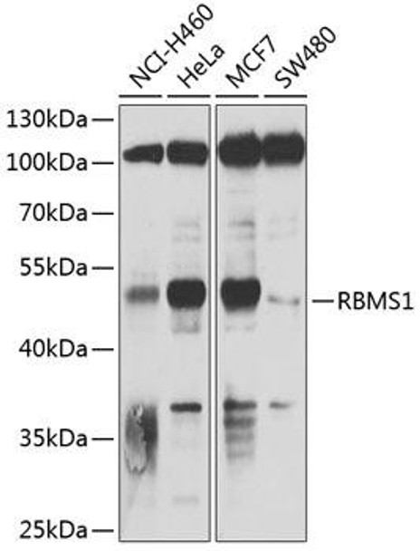 Epigenetics and Nuclear Signaling Antibodies 3 Anti-RBMS1 Antibody CAB3079
