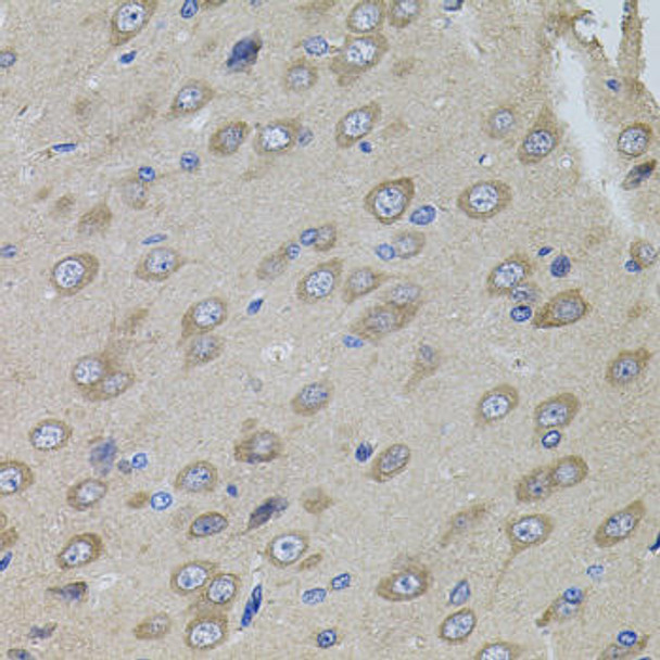 Signal Transduction Antibodies 2 Anti-SUMO3 Antibody CAB3099