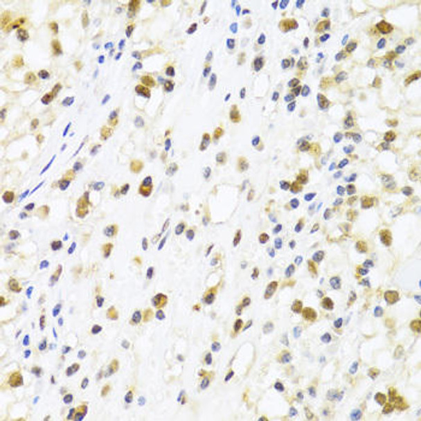 Signal Transduction Antibodies 2 Anti-SUMO4 Antibody CAB3100