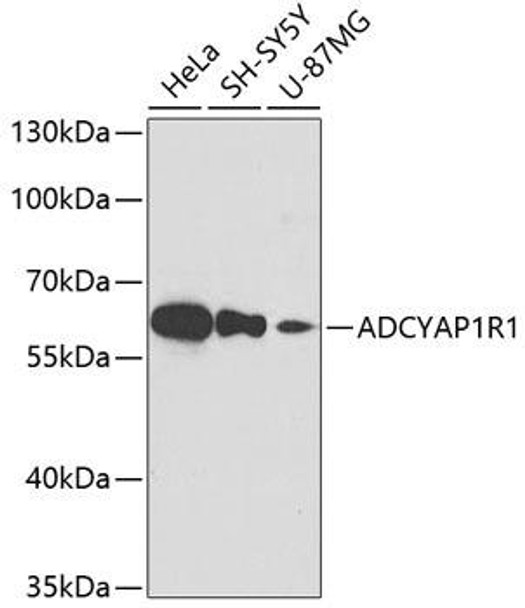 Developmental Biology Anti-ADCYAP1R1 Antibody CAB3120