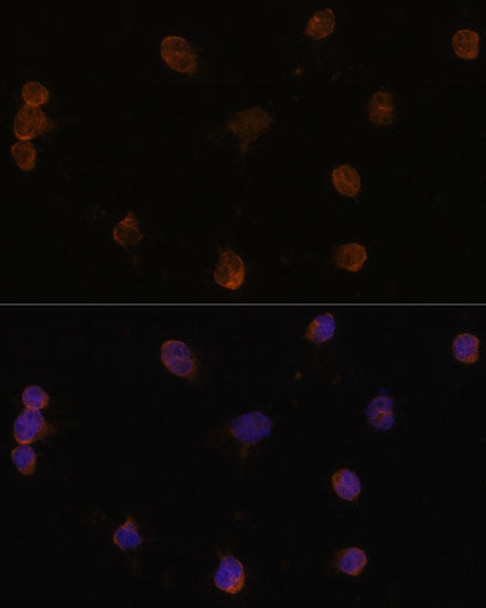 Neuroscience Anti-SLC32A1 Antibody CAB3129