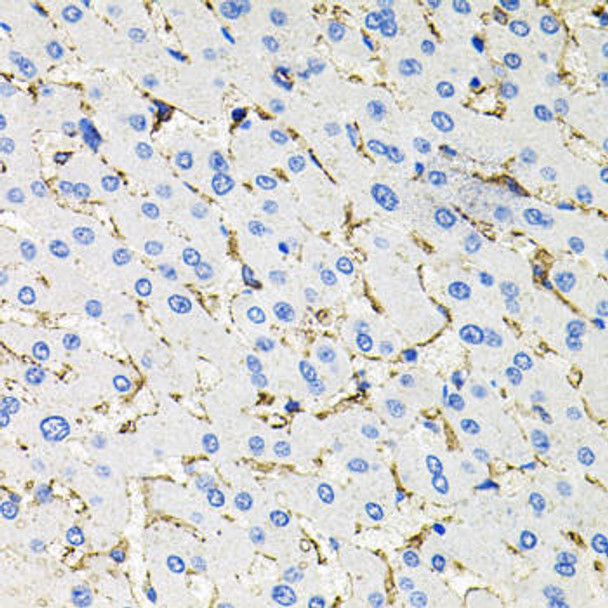 Cell Biology Antibodies 8 Anti-SSTR2 Antibody CAB3135