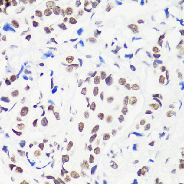 Epigenetics and Nuclear Signaling Antibodies 3 Anti-MonoMethyl-Histone H3-R8 Antibody CAB3156