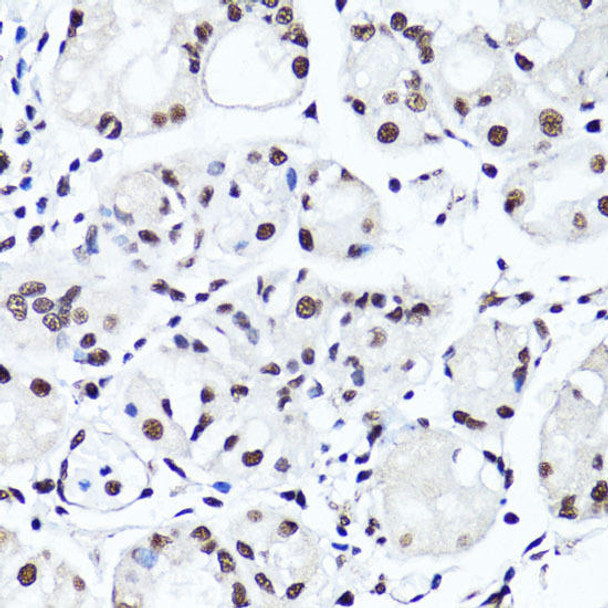 Cell Biology Antibodies 8 Anti-Symmetric DiMethyl-Histone H4-R3 Antibody CAB3159