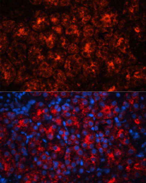 Cell Death Antibodies 1 Anti-LCN2 Antibody CAB3176