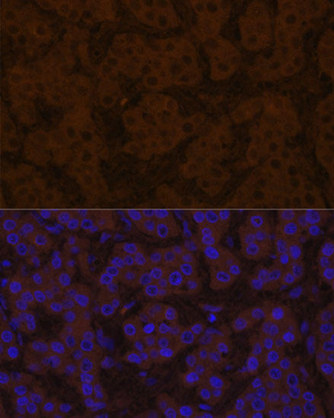 Signal Transduction Antibodies 2 Anti-TTR Antibody CAB3186