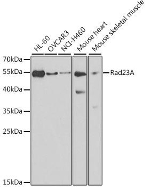 Epigenetics and Nuclear Signaling Antibodies 3 Anti-Rad23A Antibody CAB3188