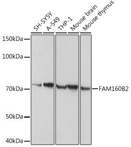 Cell Biology Antibodies 8 Anti-FAM160B2 Antibody CAB3192