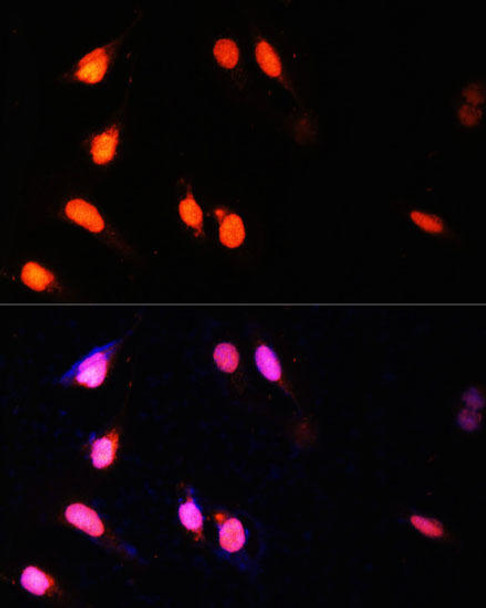 Immunology Antibodies 2 Anti-SETD2 Antibody CAB3194