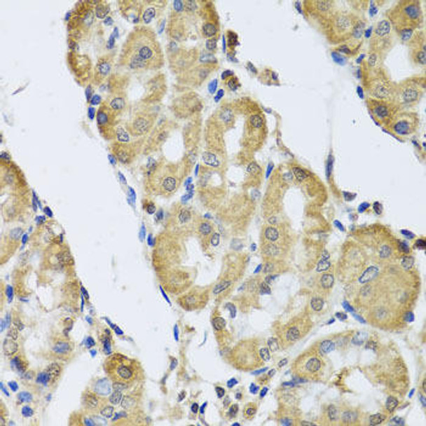 Developmental Biology Anti-CAMK2G Antibody CAB3231