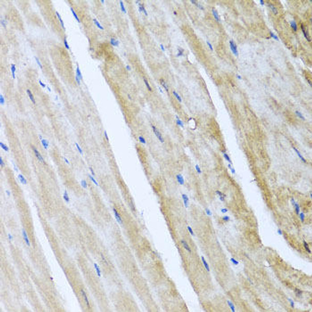 Developmental Biology Anti-CAMK2G Antibody CAB3231