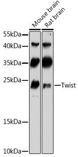 Cell Biology Antibodies 8 Anti-Twist Antibody CAB3237