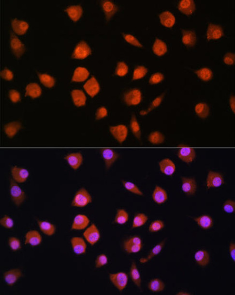 Signal Transduction Antibodies 2 Anti-NPLOC4 Antibody CAB3256