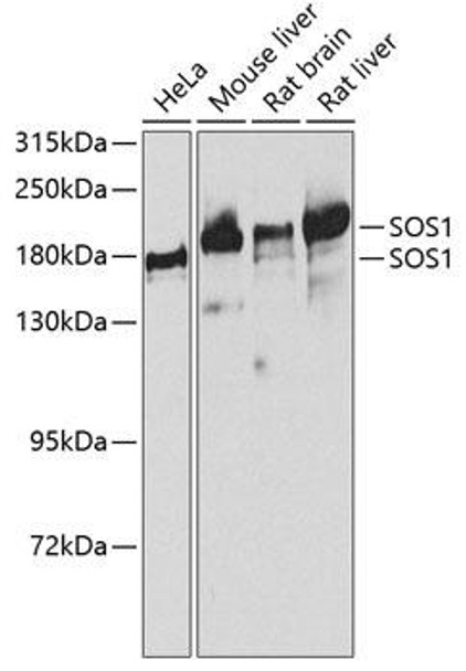 Cell Biology Antibodies 8 Anti-SOS1 Antibody CAB3272