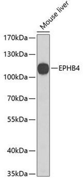 Cardiovascular Antibodies Anti-EPHB4 Antibody CAB3293