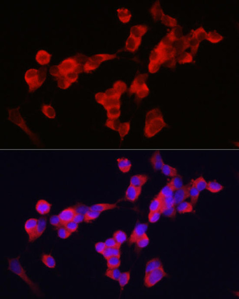 Cell Biology Antibodies 8 Anti-KIF5A Antibody CAB3303