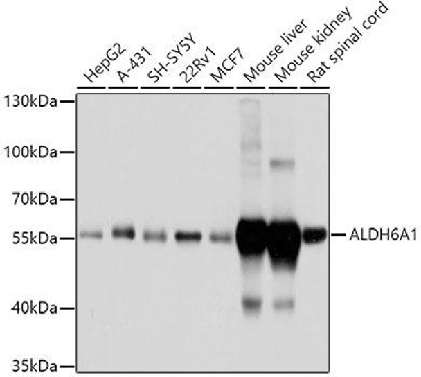 Cell Biology Antibodies 8 Anti-ALDH6A1 Antibody CAB3309