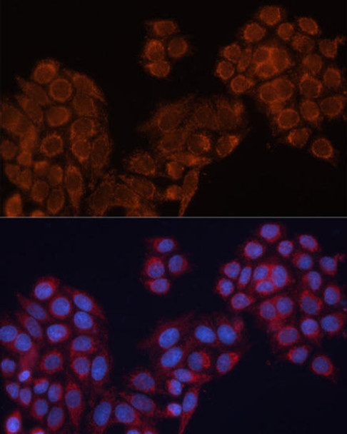 Cell Biology Antibodies 8 Anti-ALDH6A1 Antibody CAB3309