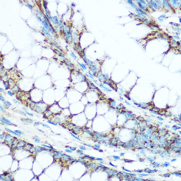 Cell Biology Antibodies 8 Anti-UQCRC1 Antibody CAB3339