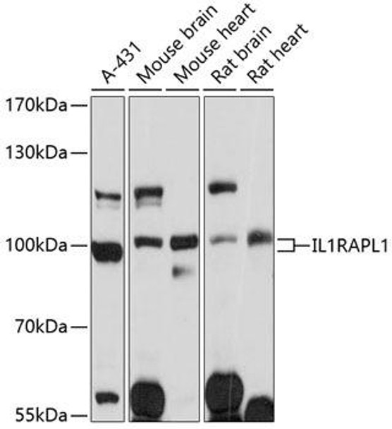 Cell Biology Antibodies 8 Anti-IL-1RAPL1 Antibody CAB3378