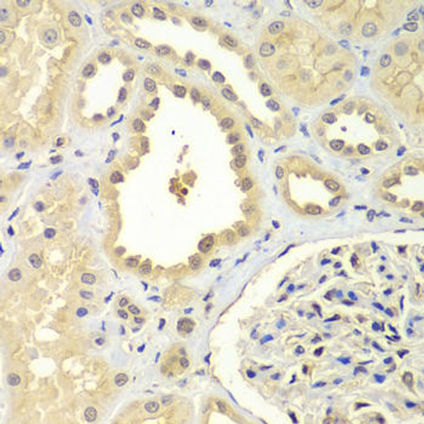 Cell Biology Antibodies 8 Anti-ZNF346 Antibody CAB3397