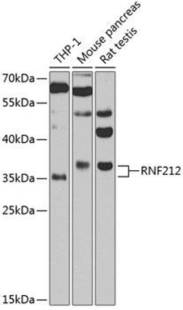 Cell Biology Antibodies 8 Anti-RNF212 Antibody CAB3569