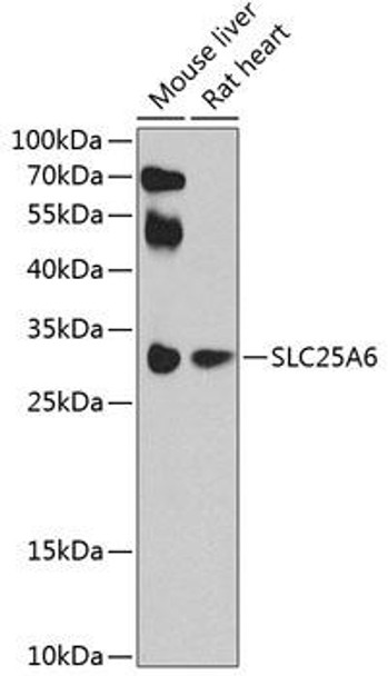 Cell Death Antibodies 2 Anti-SLC25A6 Antibody CAB3585