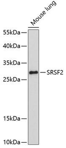 Epigenetics and Nuclear Signaling Antibodies 3 Anti-SRSF2 Antibody CAB3635