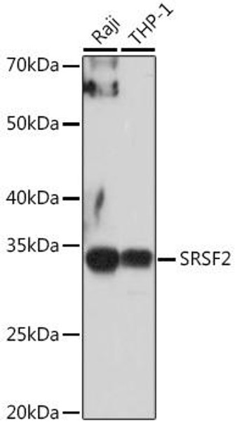 Epigenetics and Nuclear Signaling Antibodies 3 Anti-SRSF2 Antibody CAB3635