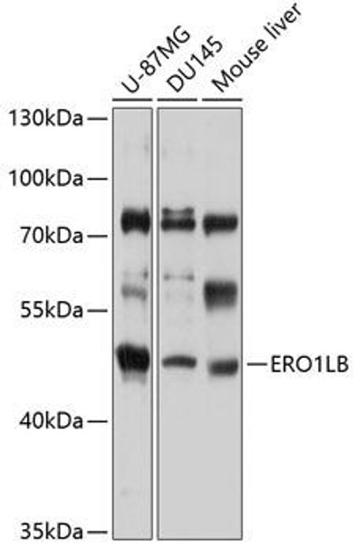 Cell Biology Antibodies 8 Anti-ERO1LB Antibody CAB3682